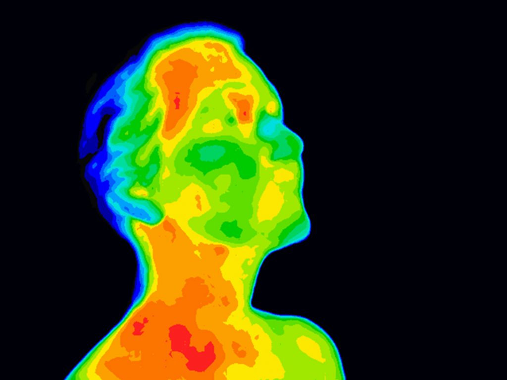 Thermographic image of human