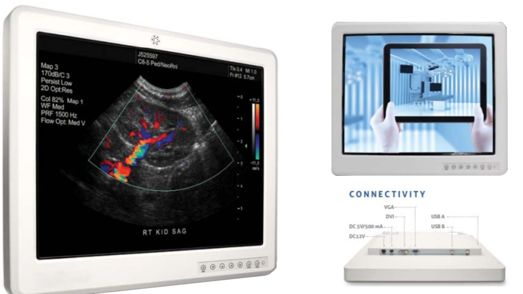 Displays Suitable for Medical Equipment