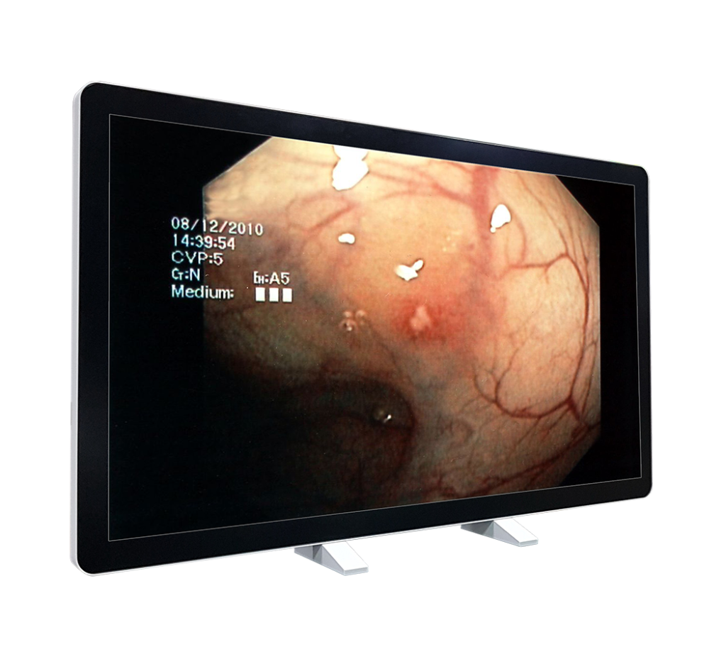 medical display avalue