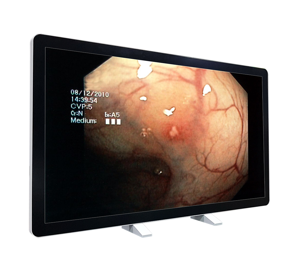 medical display avalue