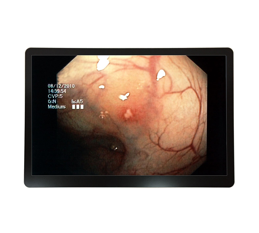 RCC-MM-GMD24G-01R