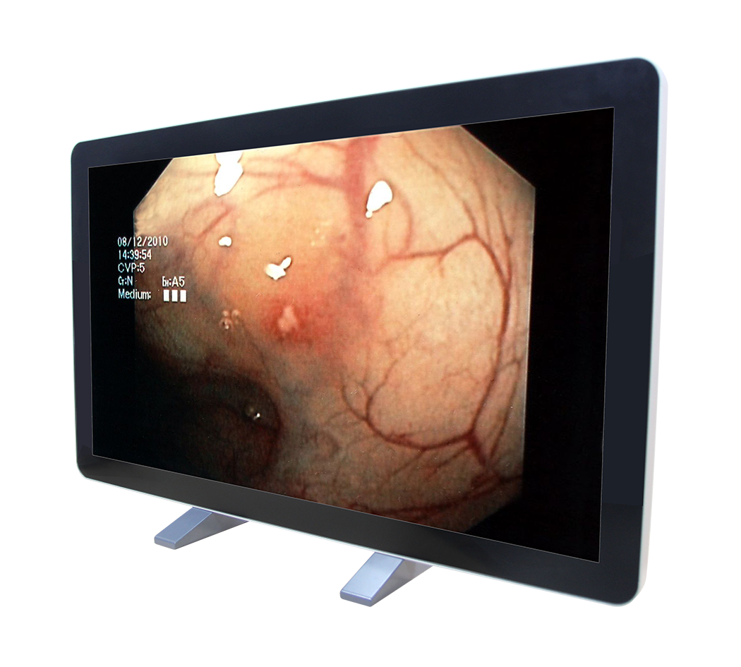 RCC-MM-GMD55G-01R
